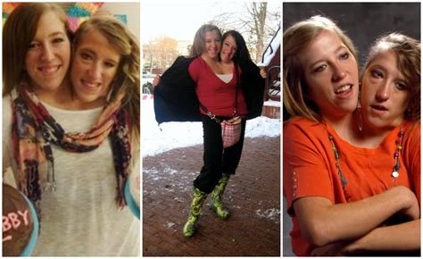Unbreakable Bond: The Extraordinary Journey Of Abby And Brittany Hensel